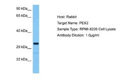PXMP3 Antibody, Novus Biologicals 100 &mu;L; Unconjugated:Antibodies, Polyclonal
